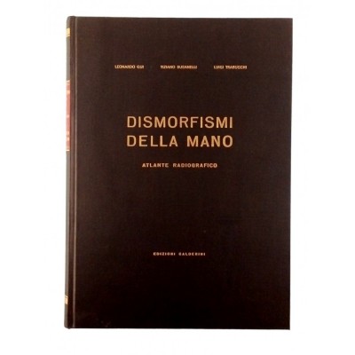 Dismorfismi della mano Atlante Radiografico Ed Calderini