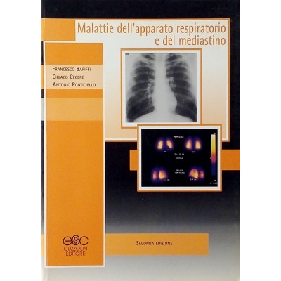 Bariffi-Cecere-Ponticiello Malattie dell'apparato respiratorio e del mediastino Cuzzolin Editore 2004