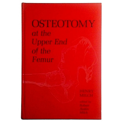 Henry Milch Osteotomy at the upper end of the femur
