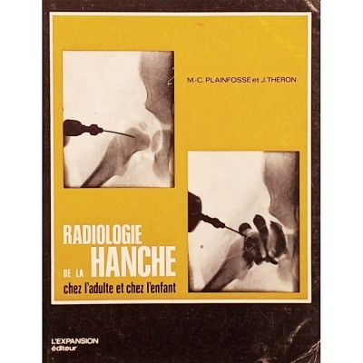 Plainfosse Theron radiologie de la hanche L'Expansion 1971 Spedizione Gratuita