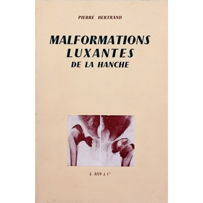 Pierre Bertrand Malformations Luxantes de la Hanche Doin et CIE Editeurs 1962