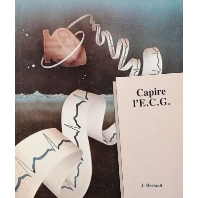 J Hertault Capire l'E C G Edilerner International 1986